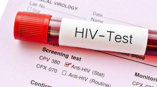 HIV Test